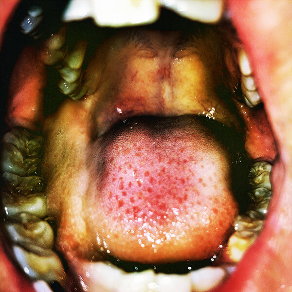 Hana Vu - Public Storage - CD